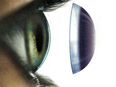 Kontaktní čočka - Oční optika IVA Brno